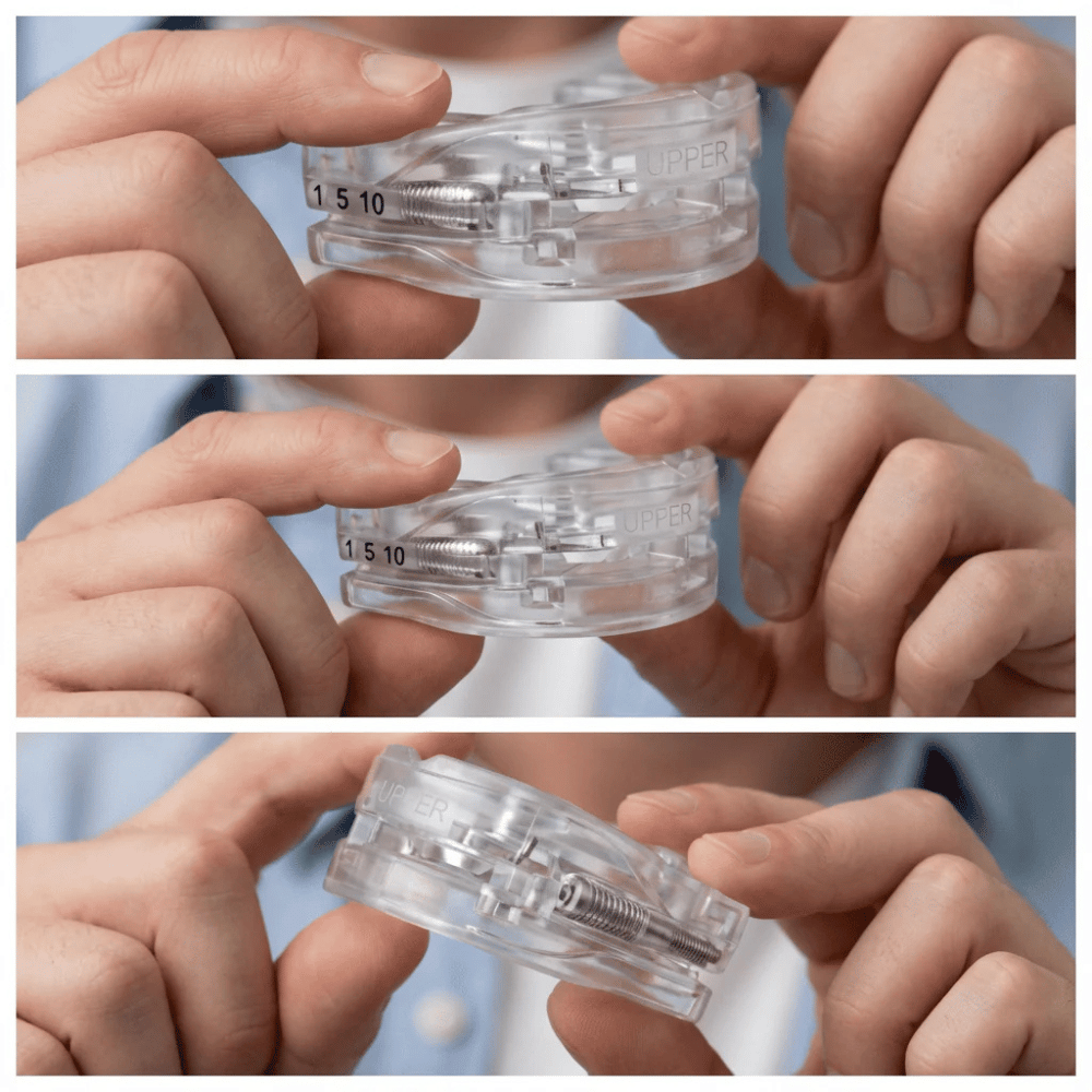Zenouv® Anti-Snoring Mouthpiece