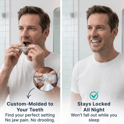 Zenouv® Anti-Snoring Mouthpiece